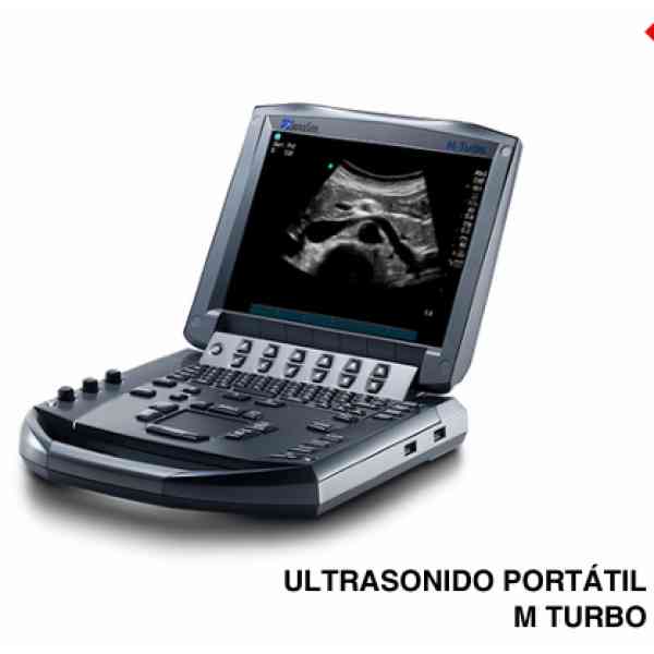 EQUIPO DE ULTRASONIDO SONOSITE - Image 4