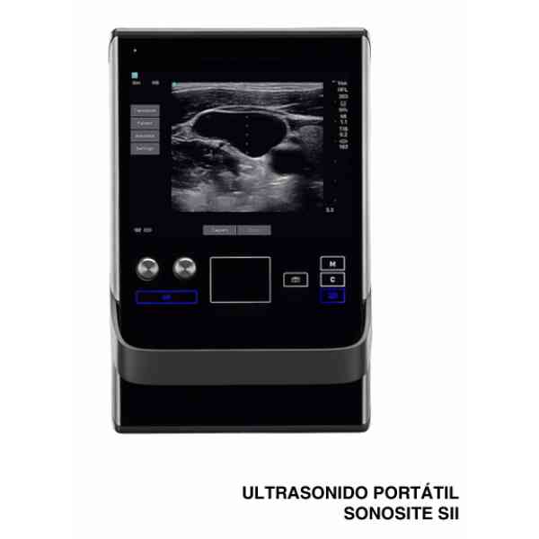 EQUIPO DE ULTRASONIDO SONOSITE - Image 2